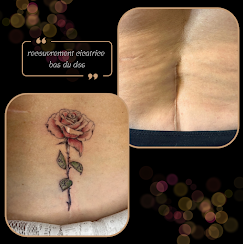 cicatrice rose